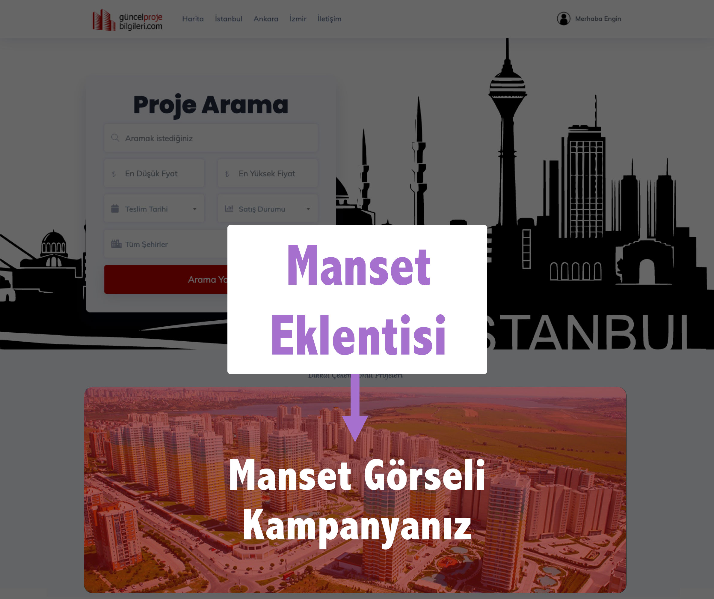 Manşet - 1 adet/ay